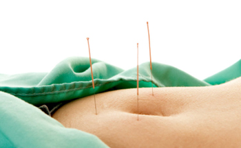 Imagem: https://www.acupunturadratamara.com.br/post/acupuntura-alivia-endometriose