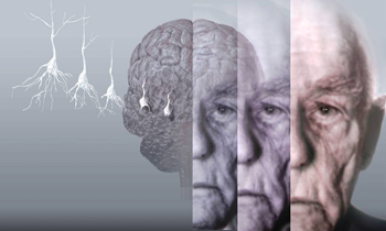 Imagem: https://oglobo.globo.com/saude/pesquisadores-identificam-gene-que-envelhece-cerebro-21068143